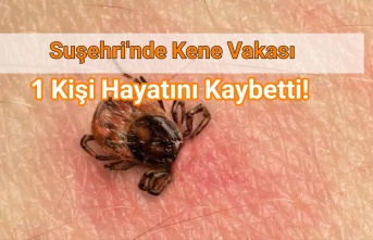 Suşehri'inde Kene Vakası 1 kişi Hayatını Kaybetti!