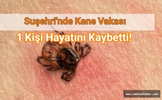Suşehri'inde Kene Vakası 1 kişi Hayatını Kaybetti!