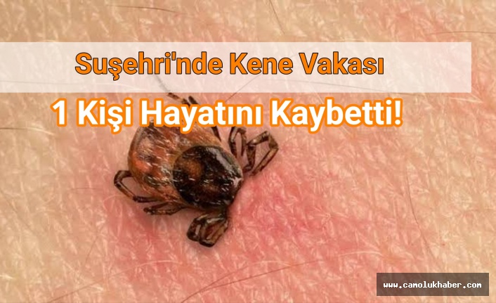 Suşehri'inde Kene Vakası 1 kişi Hayatını Kaybetti!